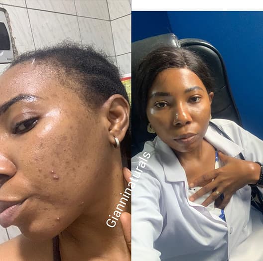 Transformation Aisha N.